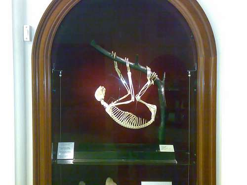 El Museo del Bisturí, en Edimburgo El Museo del Bisturí, en Edimburgo